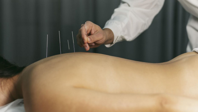 imagen Acupuntura: sumamos una terapia complementaria milenaria
